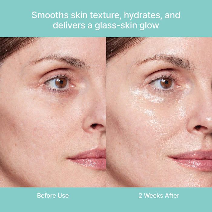 REJURAN Healer Turnover Ampoule 30ml