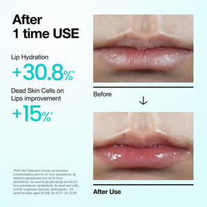 Anua PDRN Lip Serum 10ml+10ml [DUO SET], image 3