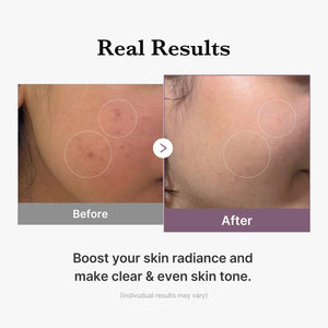 medicube AGE-R Glutathione Glow Toner 140ml, image 5