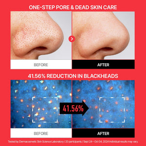 Parnell AHA Omija Ceramic Bubble Peeling Cleanser 180ml, image 4