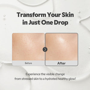 TIRTIR SOS Serum 50ml, image 4