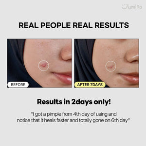 Jumiso Snail Mucin 95% + Peptide Essence 140ml, image 6