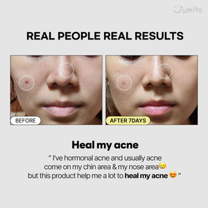 Jumiso Snail Mucin 95% + Peptide Essence 140ml, image 7